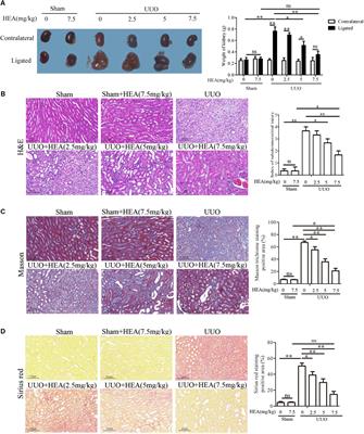N6-(2-Hydroxyethyl) Adenosine From Cordyceps cicadae Ameliorates Renal Interstitial Fibrosis and Prevents Inflammation via TGF-β1/Smad and NF-κB Signaling Pathway